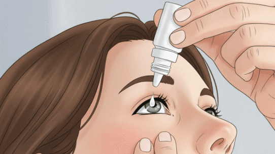 An illustration of a woman putting in artificial tears.